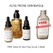 LIMITED SPECIAL Acne Prone Skin